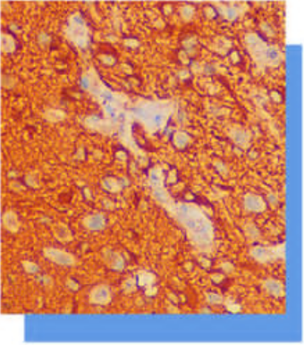 膠質(zhì)纖維酸性蛋白（Glial Fibrillary Acidic Protein，GFAP）抗體試劑